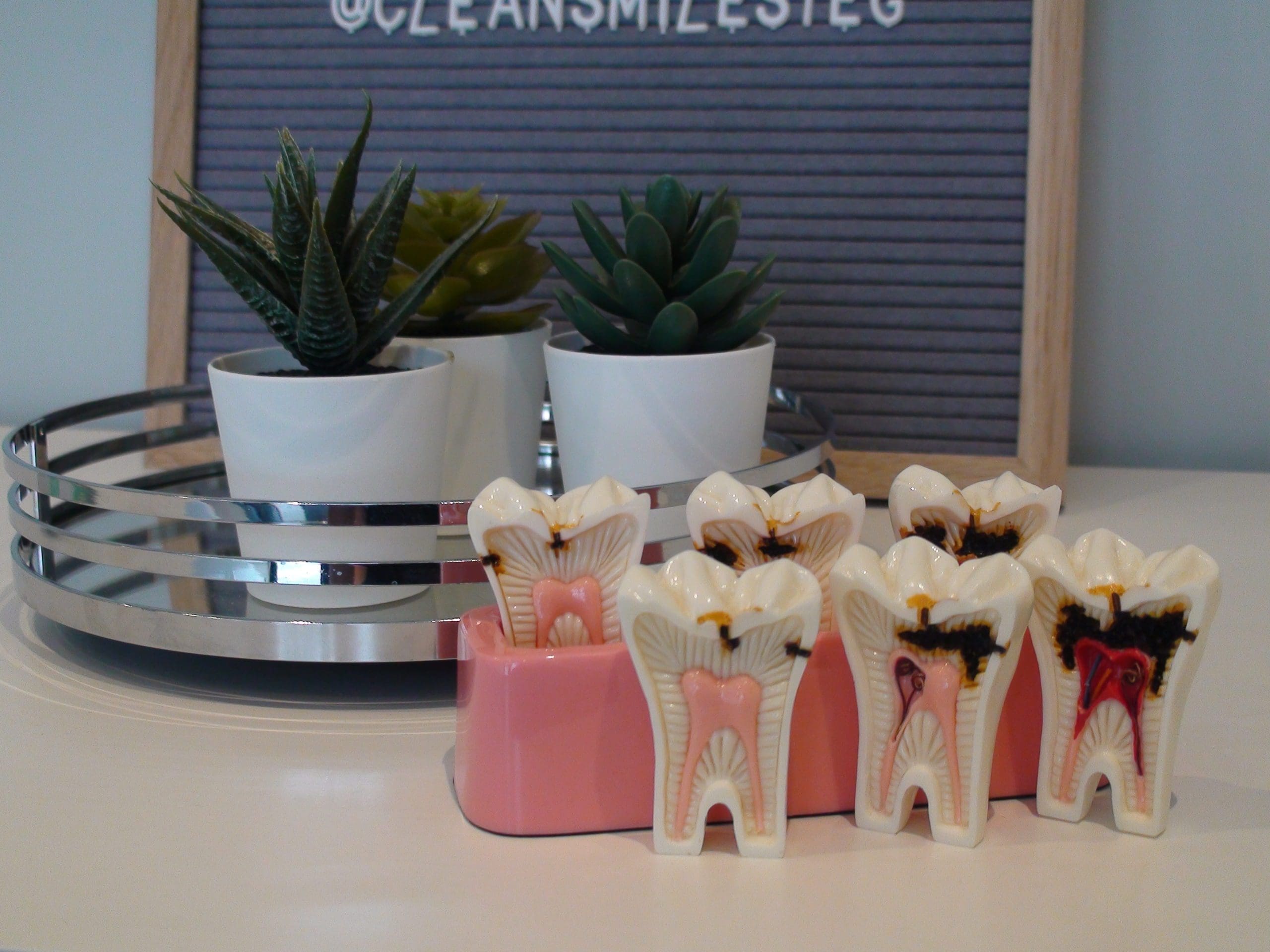 My teeth don’t hurt, how do I know I have cavities?