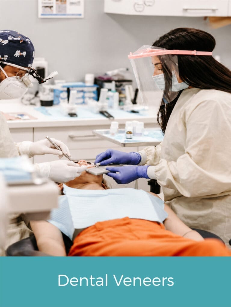 dental veneers