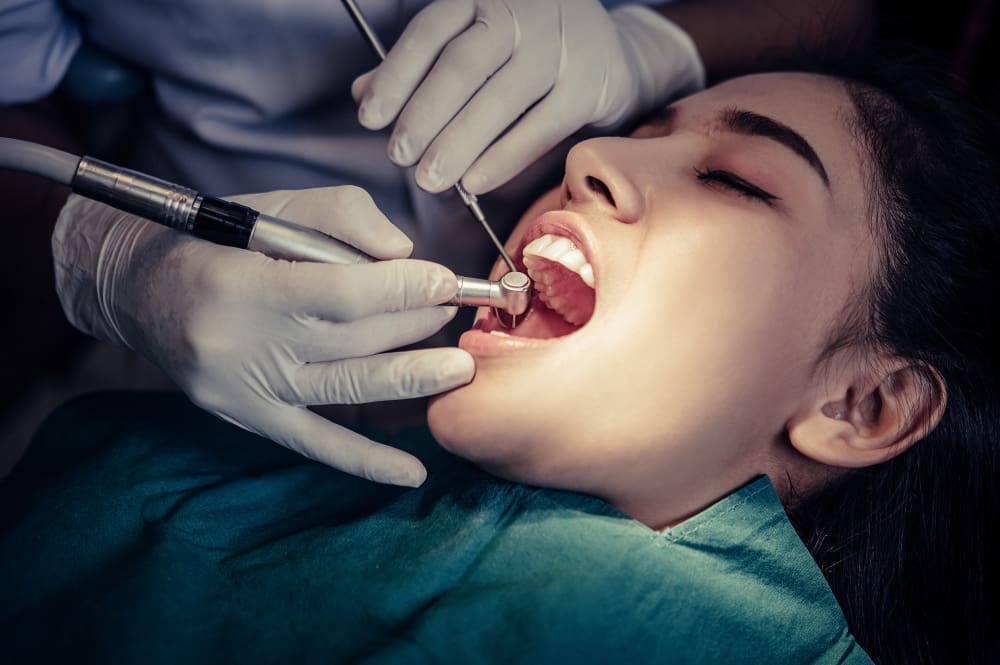 Tooth Extraction